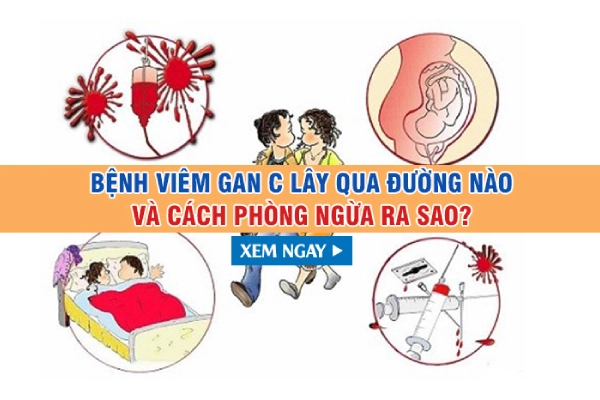 Bệnh viêm gan C lây qua đường nào và cách phòng ngừa ra sao?